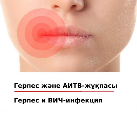 Герпес и ВИЧ-инфекция