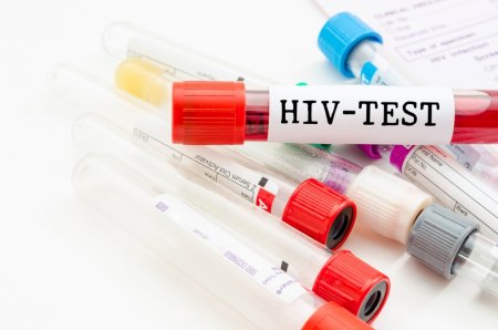 # FDA вирустық жүктемені өлшейтін АИТВ тестін мақұлдады.