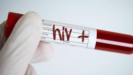 Неліктен АИТВ-позитивті адамдар өз мәртебесін жасырады